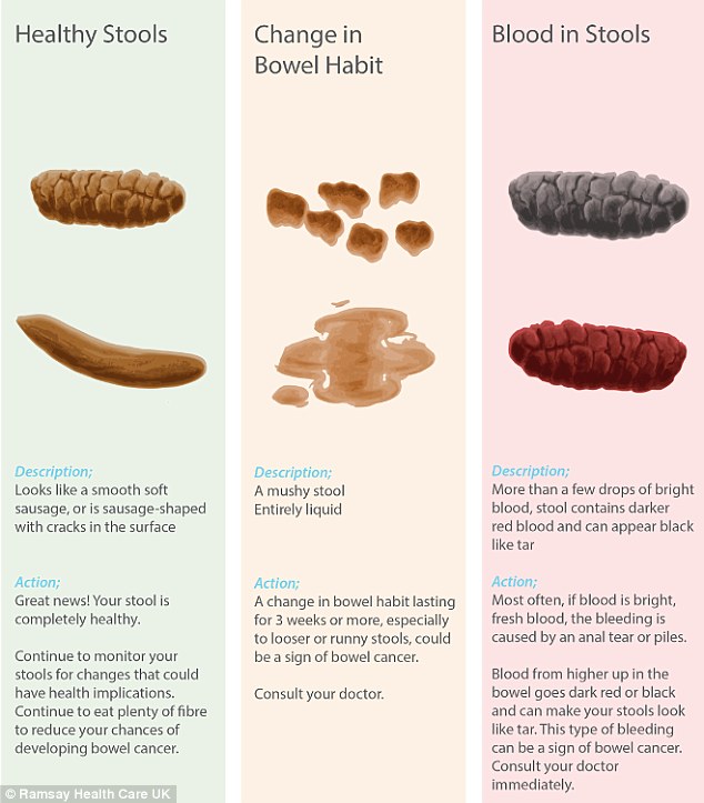 Is your poo trying to tell you something? Examples of healthy stools are shown left, with possible changes in bowel habits, middle, and cases where you should consult a doctor immediately, shown right